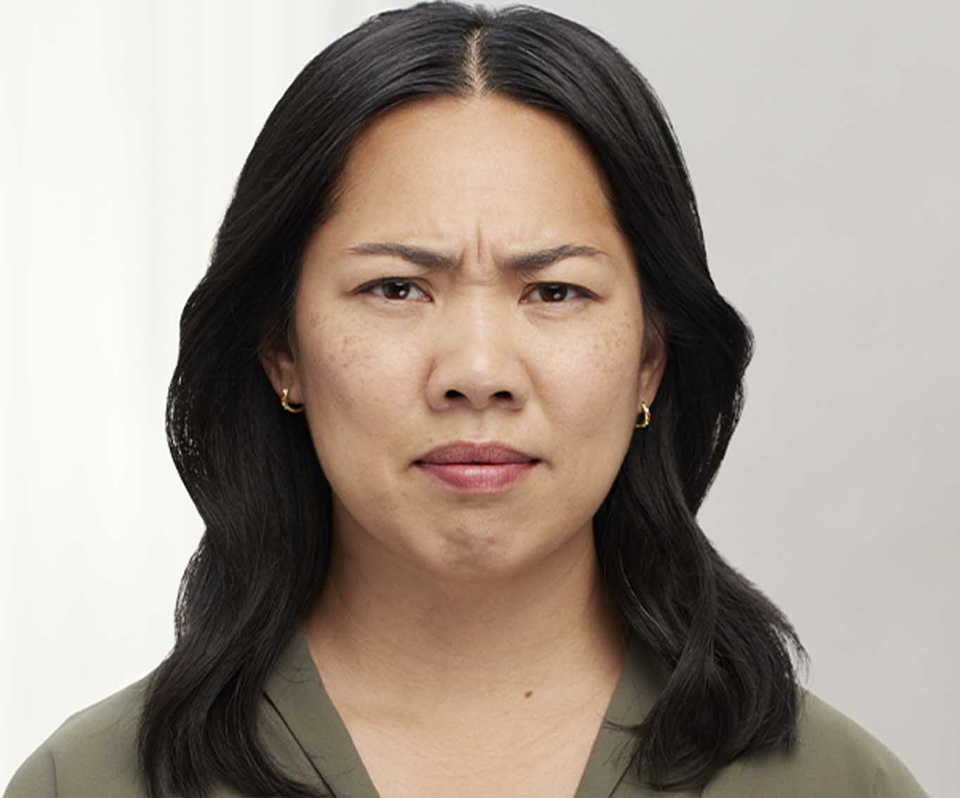 anti-wrinkle-ba-4-before